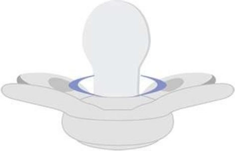 Orthodontische Silikon-Saugerform